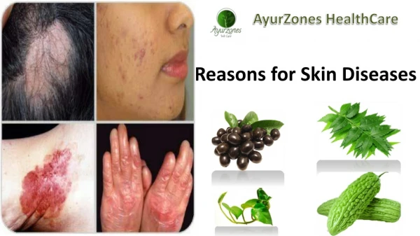 Reasons for Skin Diseases | Ayurvedic solution for skin Diseases