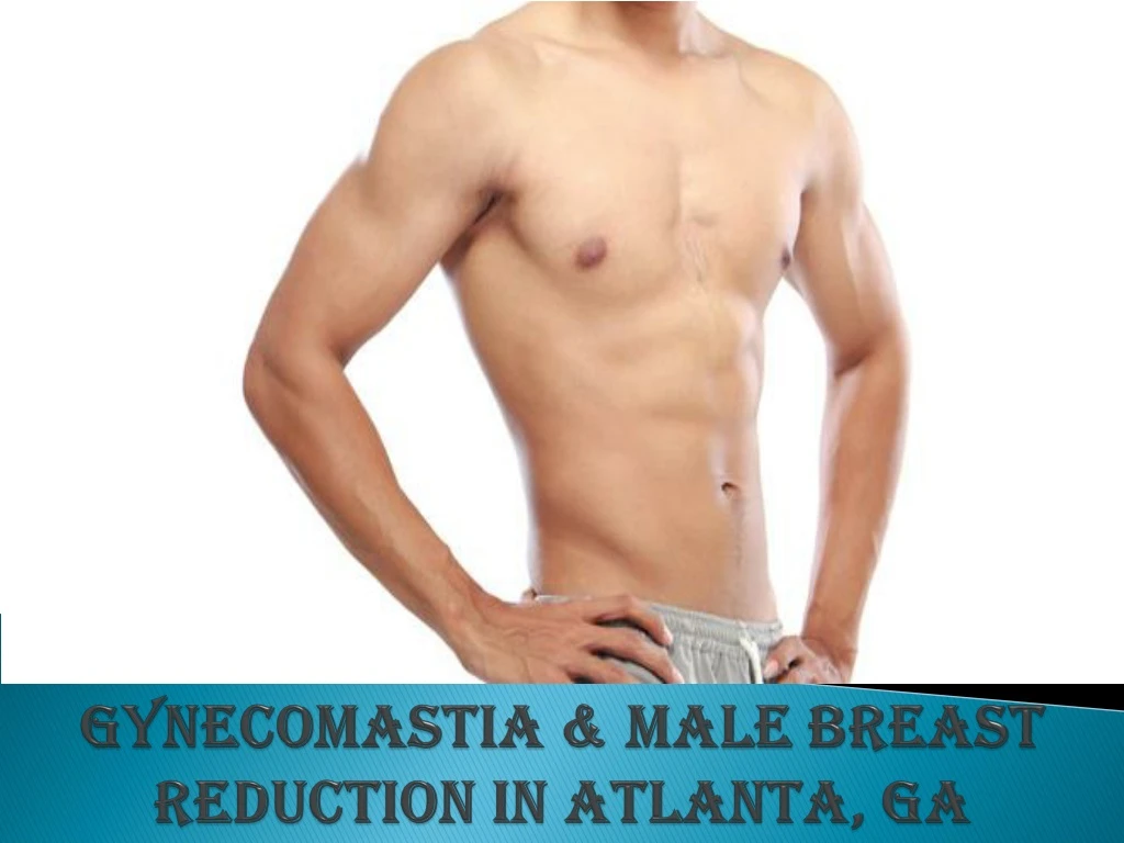 gynecomastia male breast reduction in atlanta ga