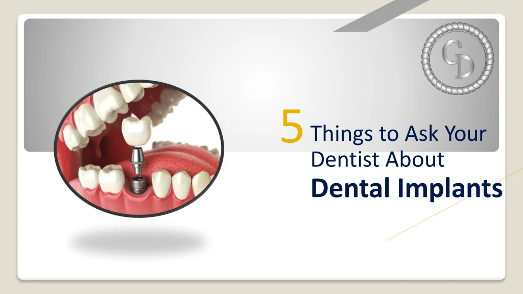 5 things to ask your dentist about dental implants