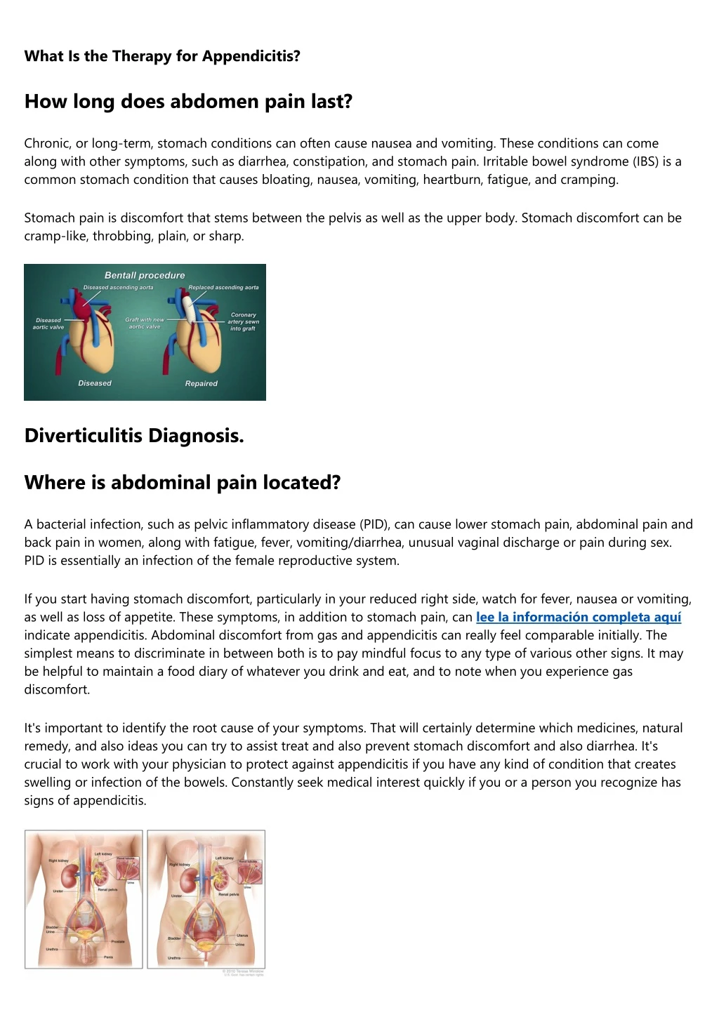 what is the therapy for appendicitis