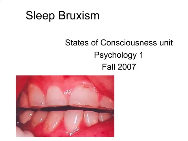 Sleep Bruxism